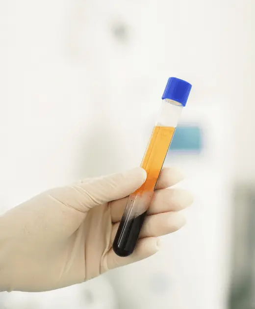 PRP Tedavisi (P-Shot, Trombositten Zengin Plazma)