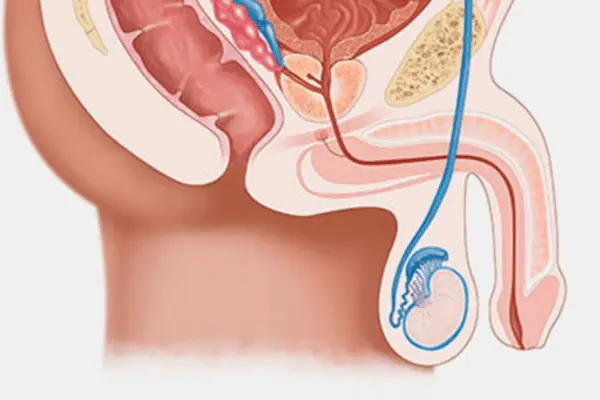 Antalya’da Sertleşme Bozukluğu Tedavisinde Yeni Nesil Yöntemler (2025 Güncel Yaklaşımlar)
